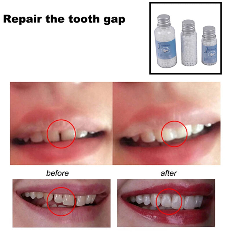 10/20/30g Teeth And Gaps FalseTeeth Solid Glue Adhesive Vampire Teeth Fangs Dentures Props Halloween Temporary Tooth Repair Kit