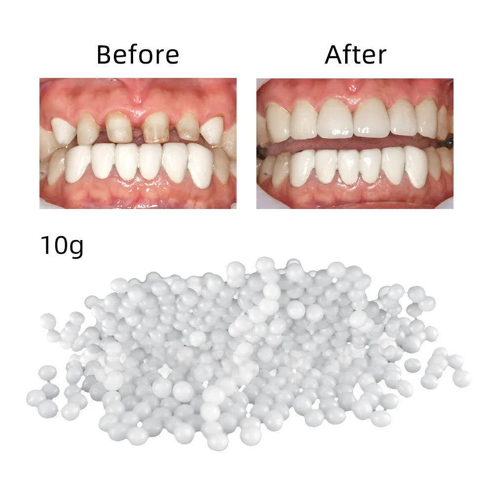 Temporary Tooth Repair Beads Missing Broken Teeth Dental Tooth Filling Material Food Grade FalseTeeth Solid Glue Denture اسنان