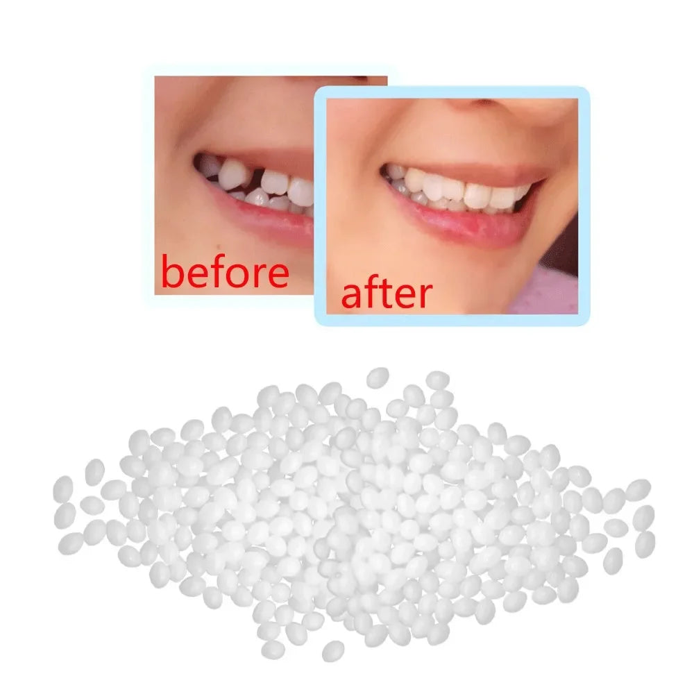 Temporary Tooth Repair Beads Missing Broken Teeth Dental Tooth Filling Material Food Grade FalseTeeth Solid Glue Denture اسنان